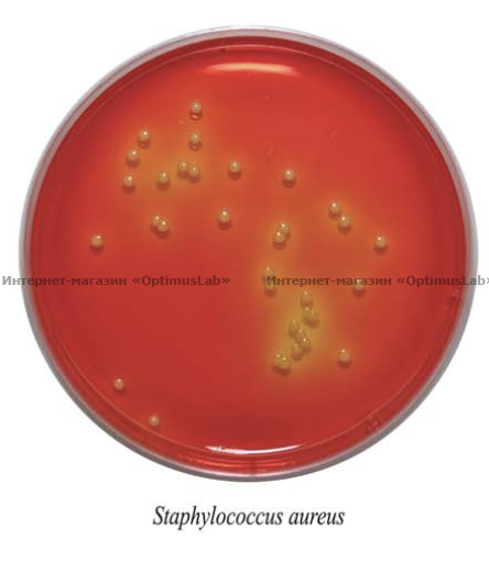 Staphylococcus aureus 5. S. aureus золотистый стафилококк. Стафилококк ауреус 10. Золотистый стафилококк на питательной среде. Staphylococcus aureus микробиология.